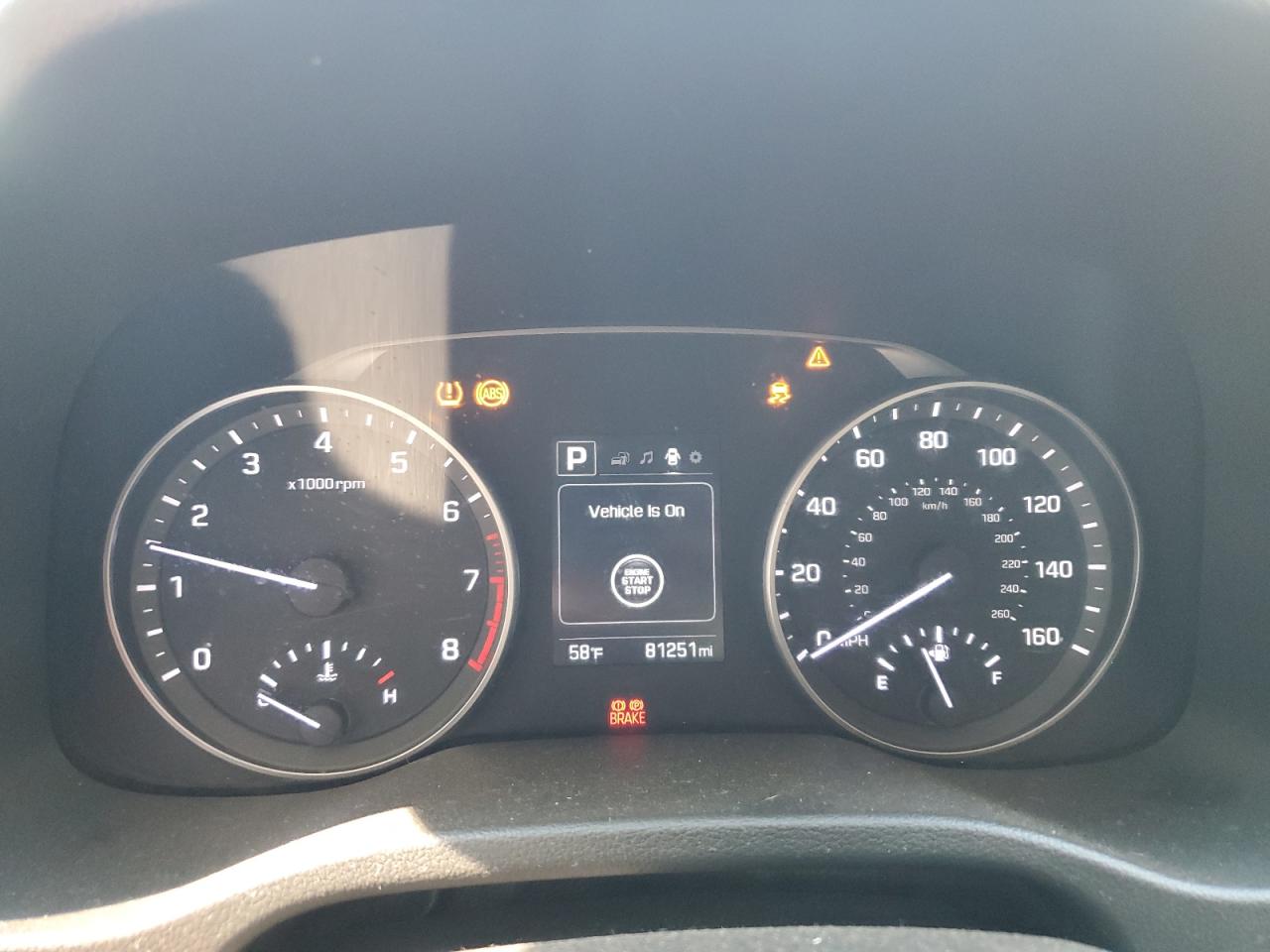 Hyundai ELANTRA Se Image 6